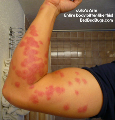 bed bugs signs. ed bug bites look like.