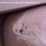 Bedbug hiding on mattress cover and feces