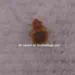 Laurens photo of a bed bug