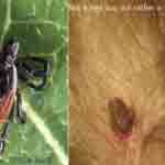 Photo of a tick not a bed bug