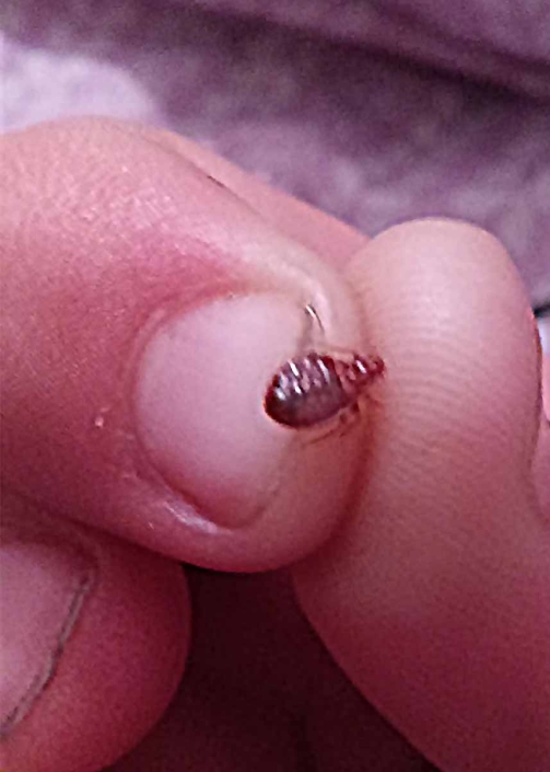 Adult bed bug held by two fingers
