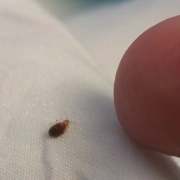 Adult bedbug showing size compared to finger hours after feeding.