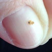 This baby bed bug on fingernail is a second instar.