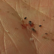 Bed bug burst open in hand exposing inspector to human blood.