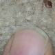 What a bed bug looks like next to a fingernail.