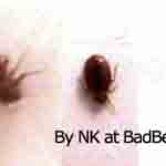 bedbug Picture by NK