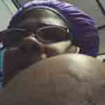 Bed Bug Bites on Black Skin Shoulder