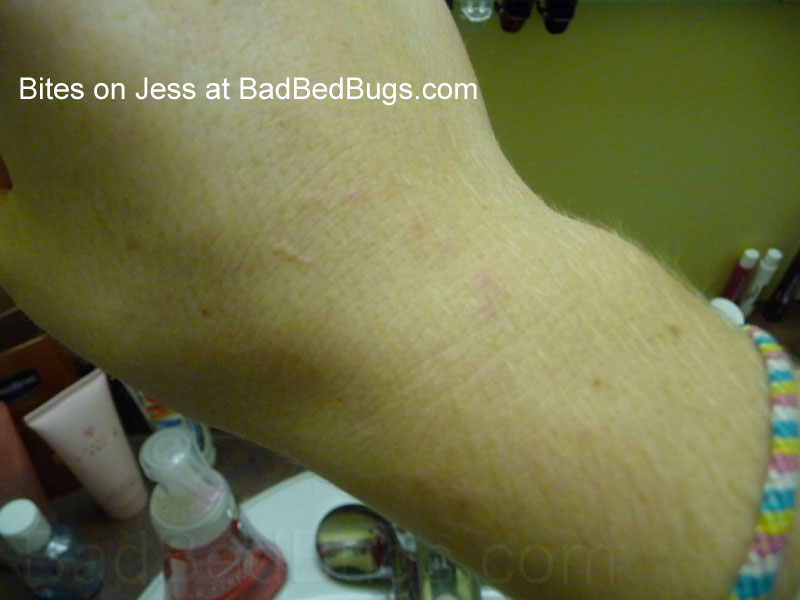 bedbugs faq: ask qestions and get answers about this pest! bedbugs faq: ask qestions and get answers about this pest!