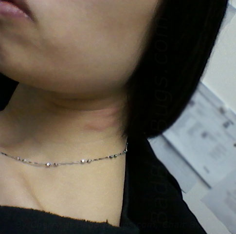 How to Kill Bed Bugs and what to expect in the process.