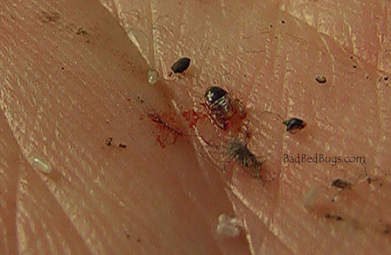 bed bugs blood bug signs human hide open check inspector checking bedbug burst exposed checklist