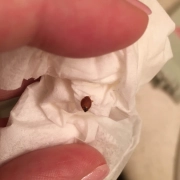 Engorged bed bug next to finger for size comparision.