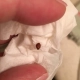 Engorged bed bug next to finger for size comparision.