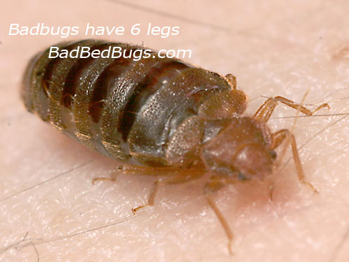 Picture of how many legs does a bed bug have?