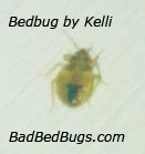 Adult bedbug after partial feeding