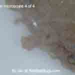 Mite picture 4 of 4 Mite picture 4 of 4