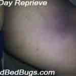 one day bedbug reprieve